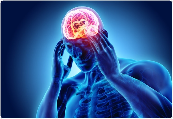 Толгой өвдөх буюу мигрень өвчний шалтгаан