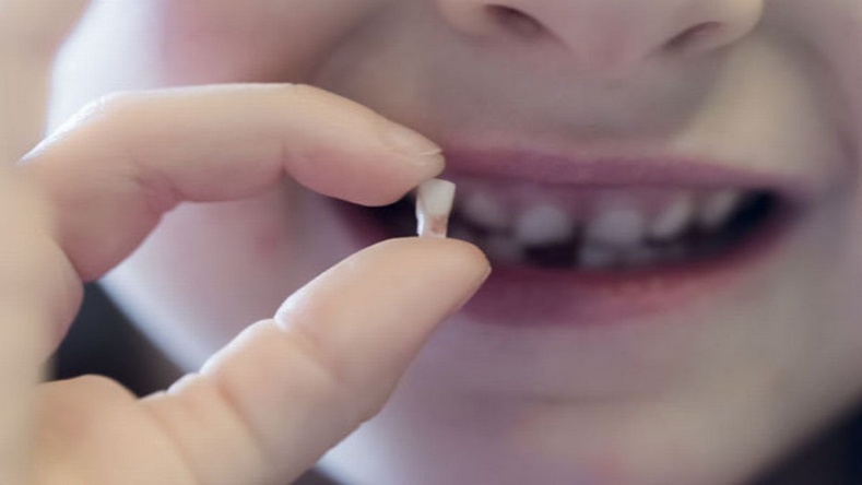 Шүдний эмч нар хүүхдийнхээ унасан шүдийг хаяхгүй байхыг зөвлөж байна