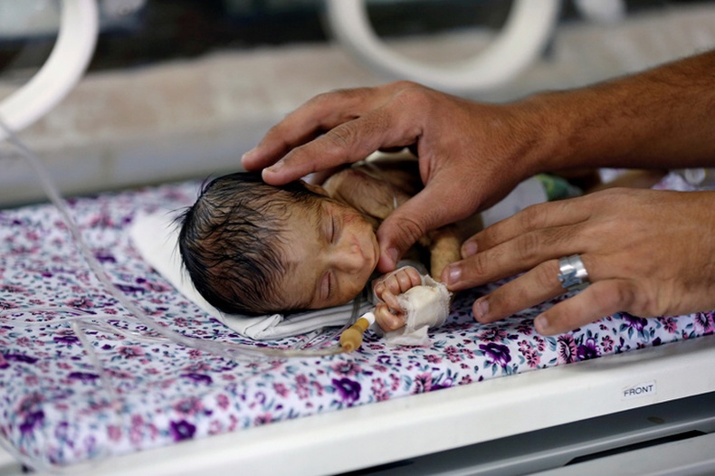 Сувилагч  дутуу төрсөн нярайд үзлэг хийж байгаа нь - Сана, Иемен